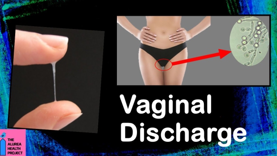 Vaginal Discharge